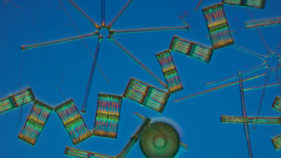 Microscope image of Fascinorbis illustris, a newly discovered diatom