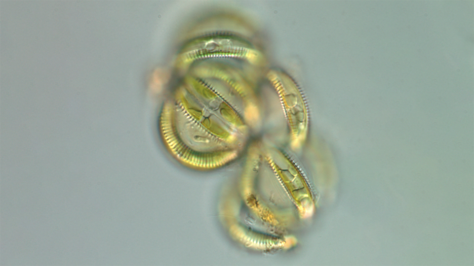 Living cells of Semiorbis eliasiae are joined in spherical colonies (Credit: M.Edlund, SCWRS, smm.org)