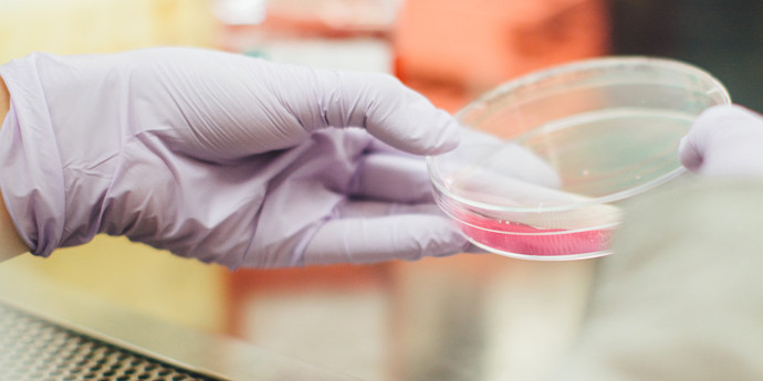 dmla-senior-recherche