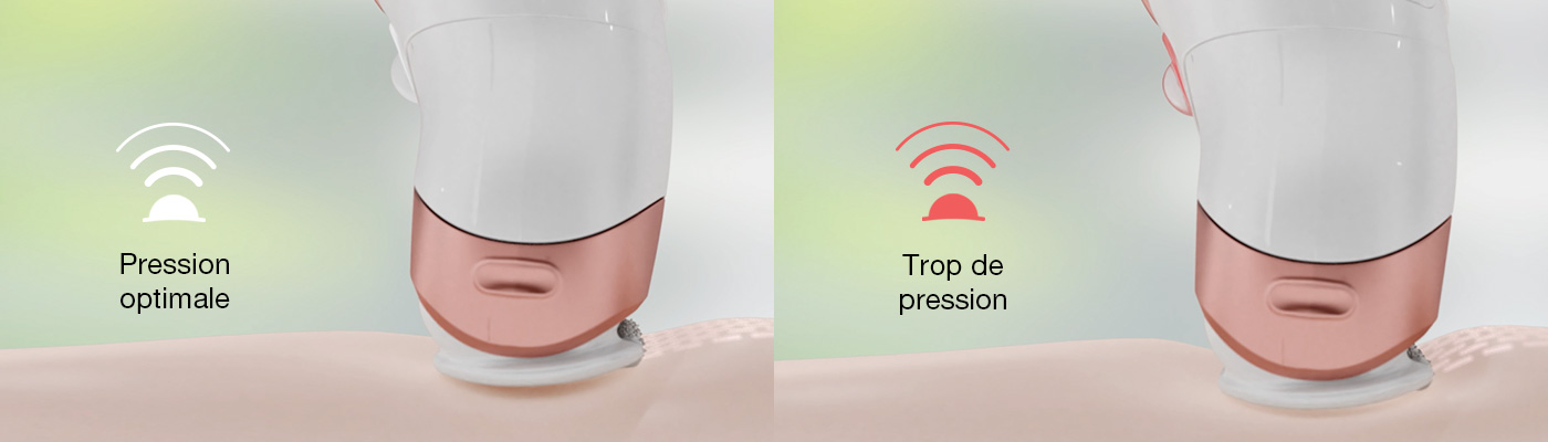 hair-removal-methods