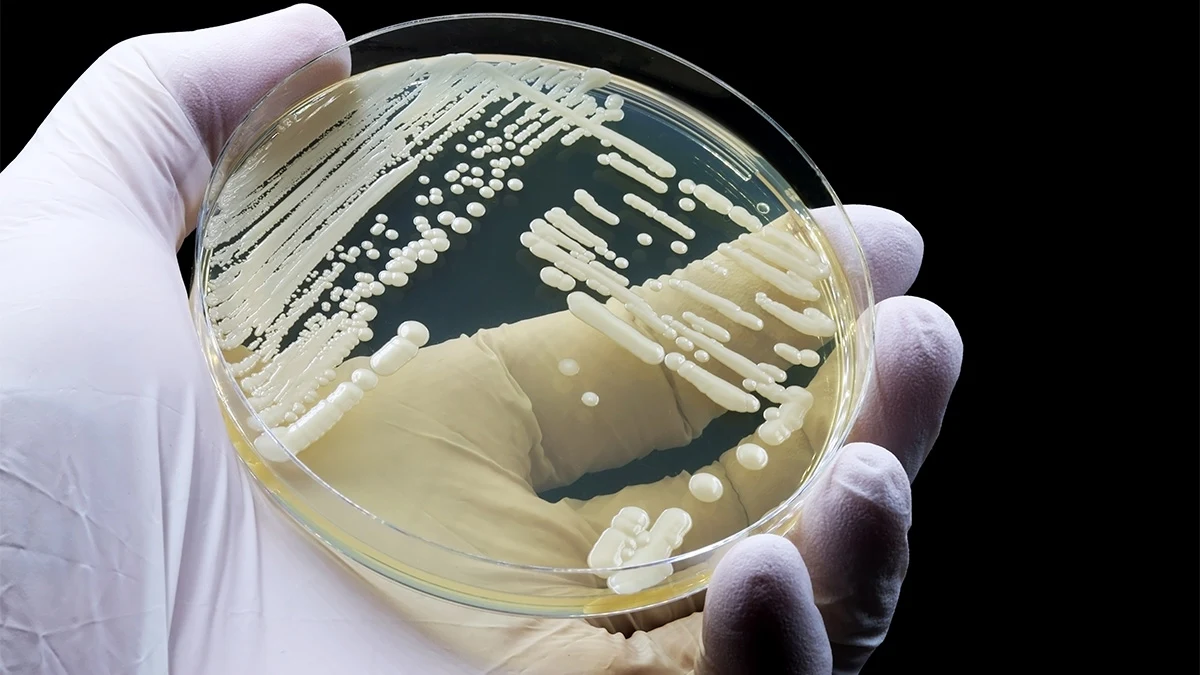 White latex gloved hand, holding a petri dish with bacteria sample.