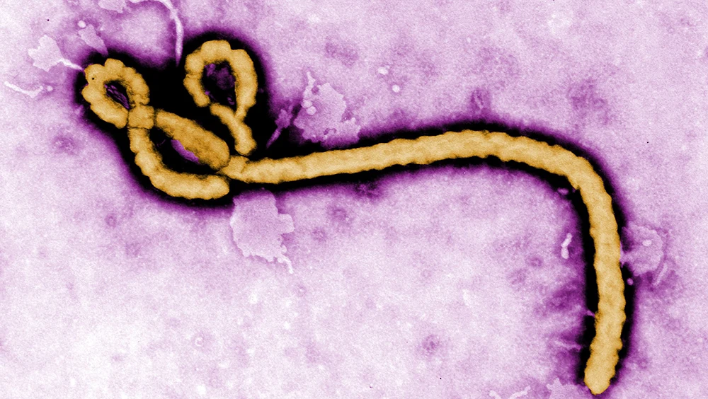 A microscopic view of the ebola virus