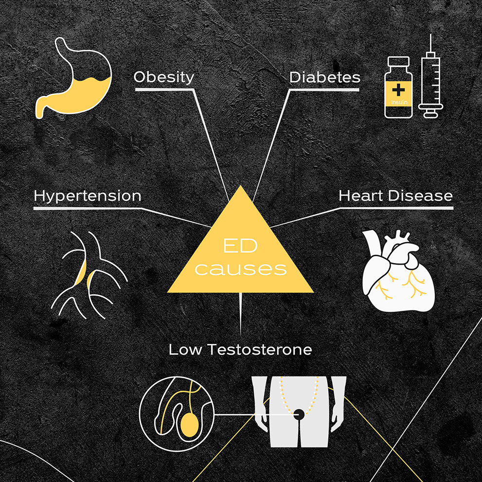 Causes of Erectile Dysfunction