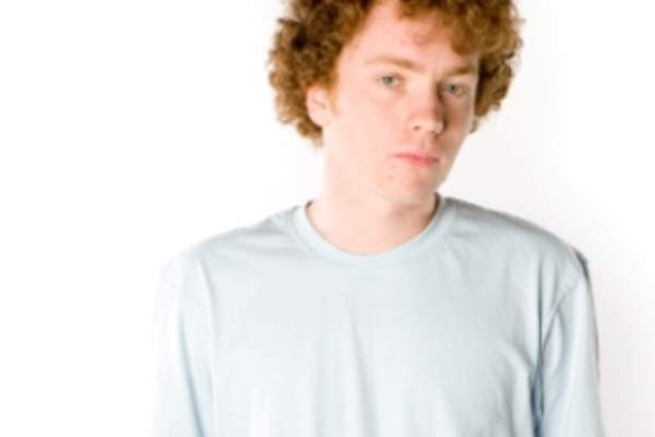 Teen with acne