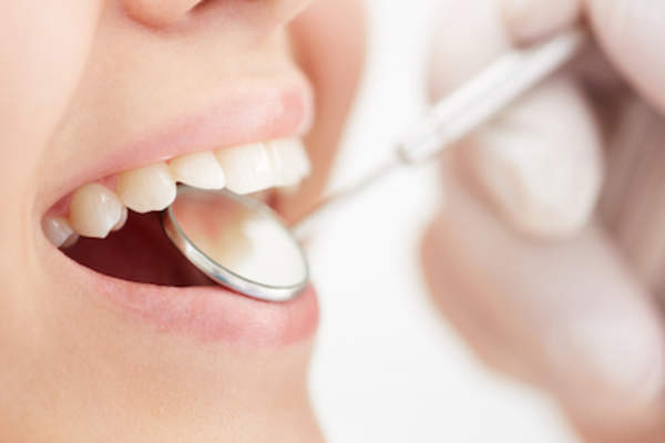 Dental check up