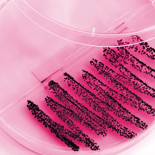 Pap test.