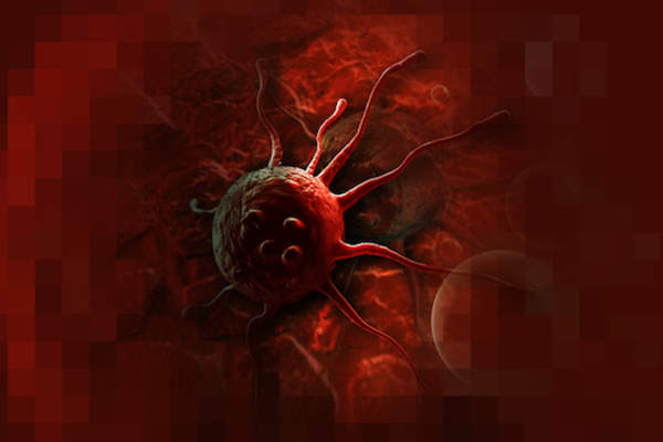 glioblastoma close up