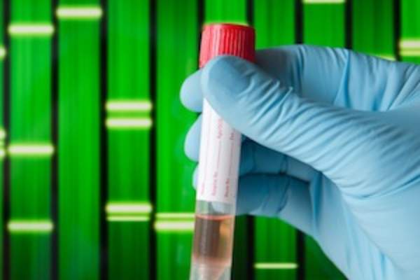 Genetic screening test.