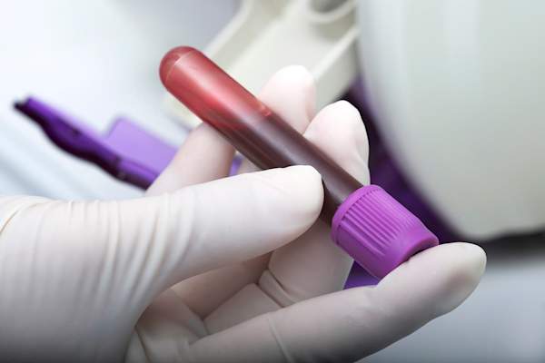 Blood test for vitamin D levels