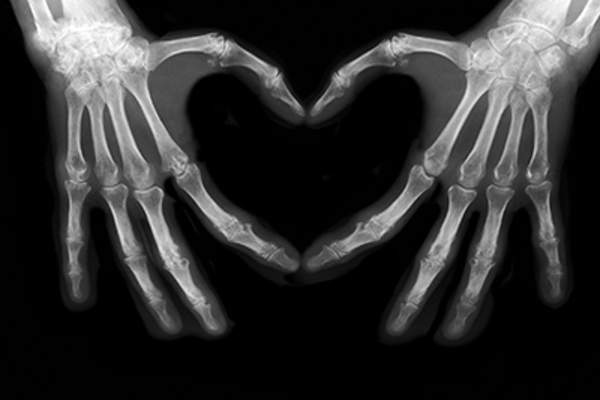 Hands in a heart shape during an x-ray.