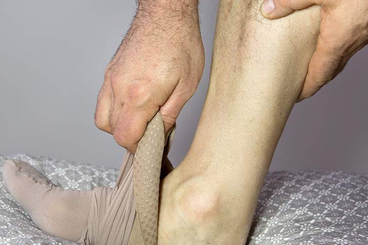 Man putting on compression stocking.