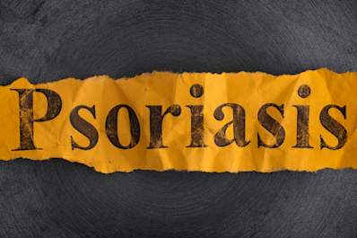Psoriasis