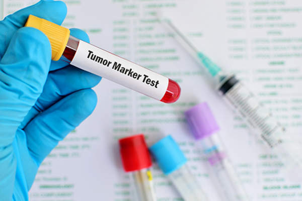 tumor marker test image