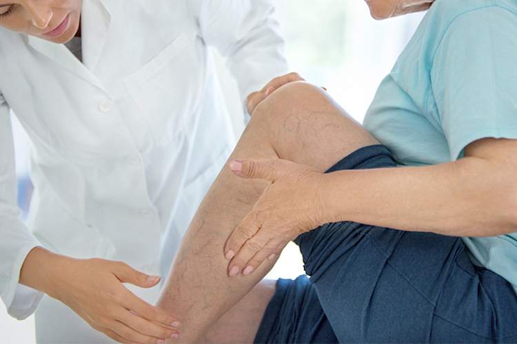 Doctor looking at the skin on a woman's lower leg.