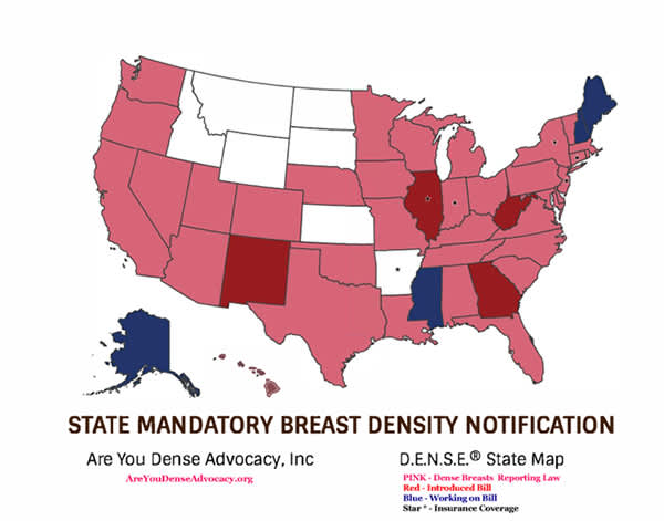 Breast density