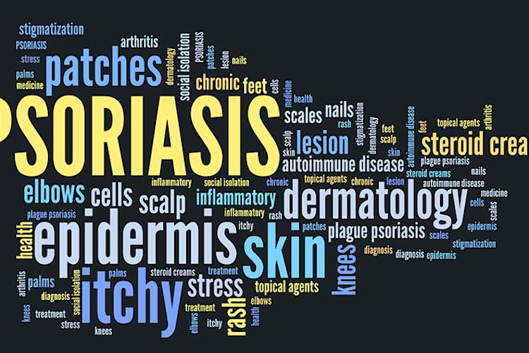 Psoriasis terms.
