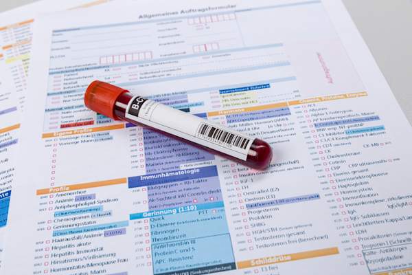 Blood test vial