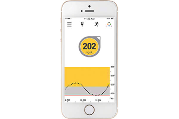 Dexcom mobile app.