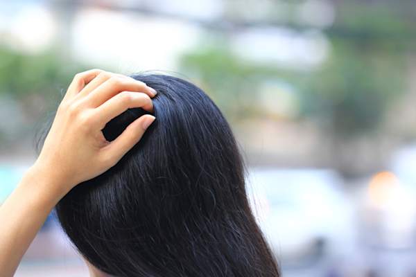 woman scratching scalp