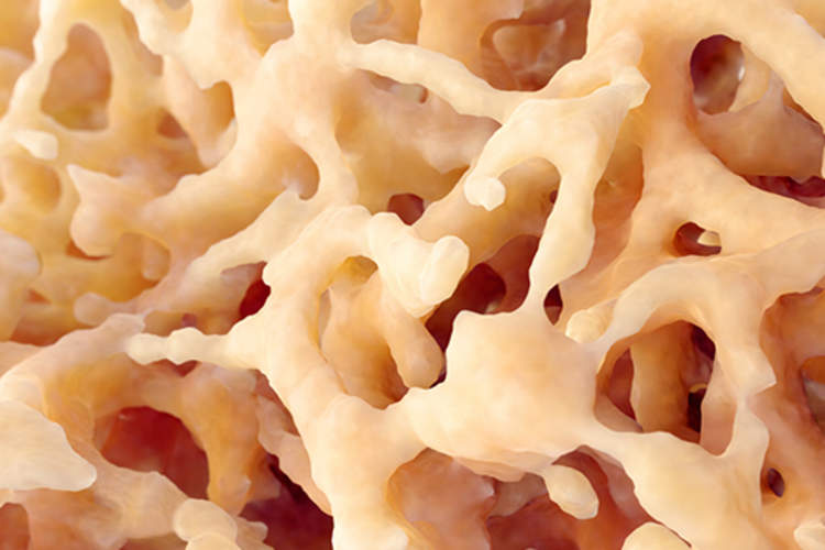 Bone tissue.