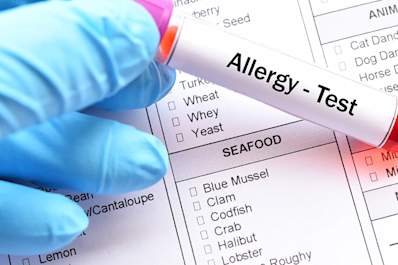 Food allergy test.