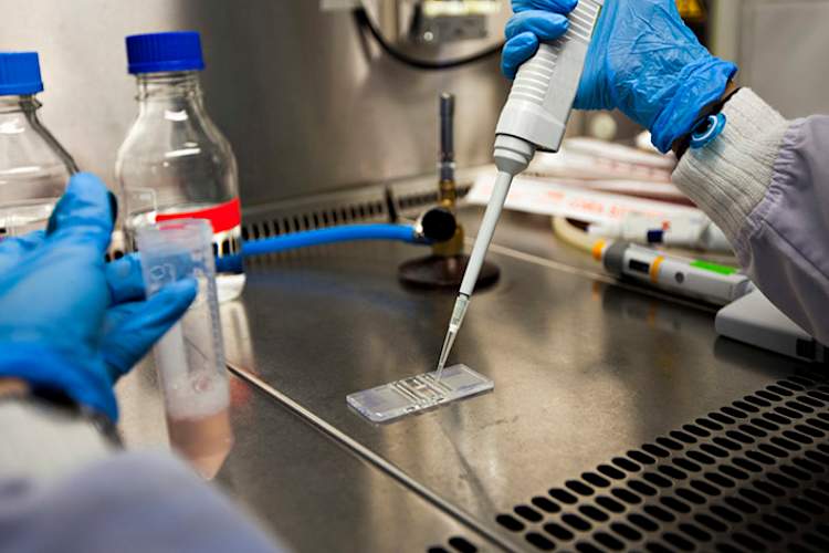 Alzheimer's disease research.