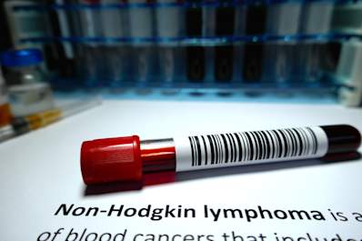 Blood test for non-hodgkin lymphoma