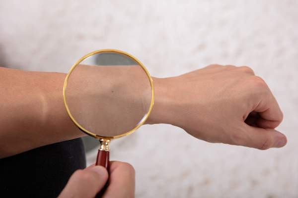 Examine self for melanomas.