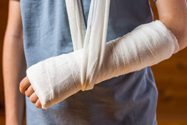 Broken arms