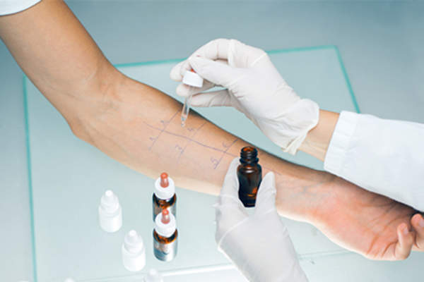 Woman having an allergy skin test.