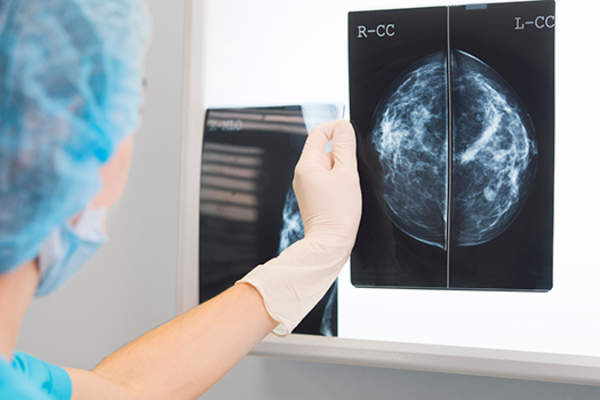 Breast surgeon looking at mammogram images.