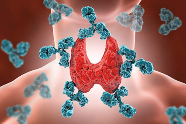 Thyroid.