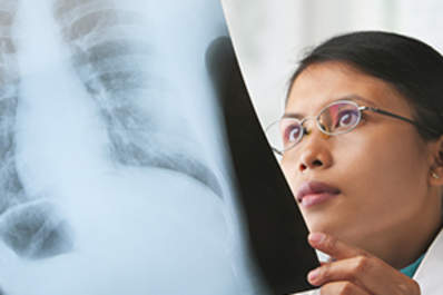 Female doctor checking x-ray