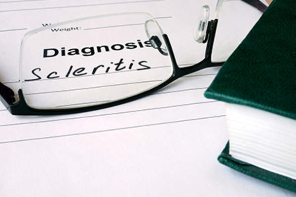 Scleritis diagnosis and eyeglasses.