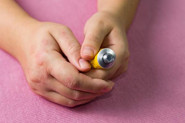 Emollient cream in the treatment and hydration of the skin.