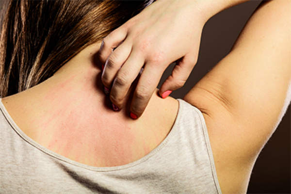 Young woman scratching the back of her neck.