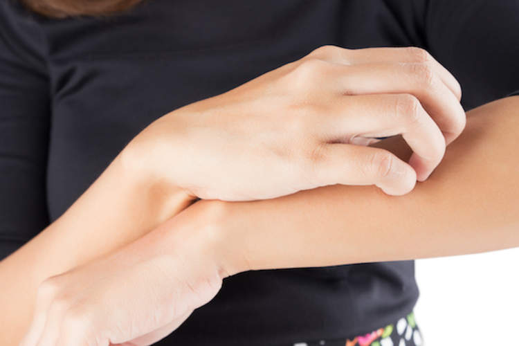 Skin Spots: What Is a Dermatofibroma?