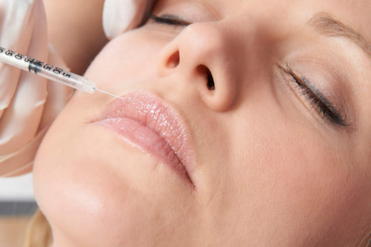 Cosmetic Fillers