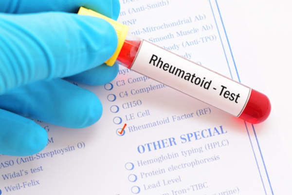 Rheumatoid blood test, checking for RF