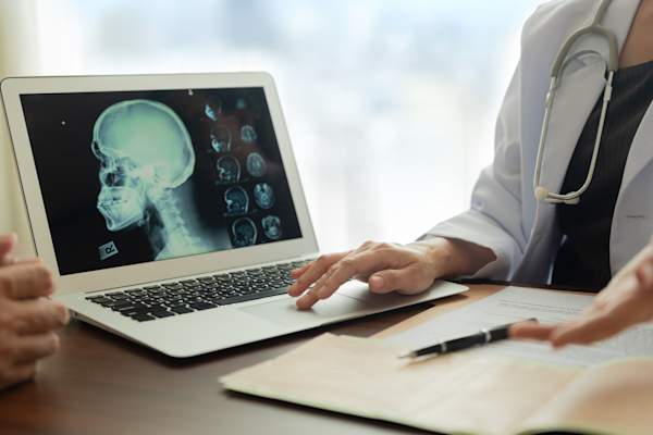 Doctor reviewing head x-rays with patient.