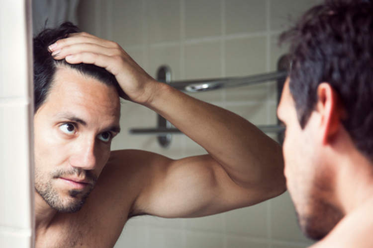 Man checking hair loss in mirror.