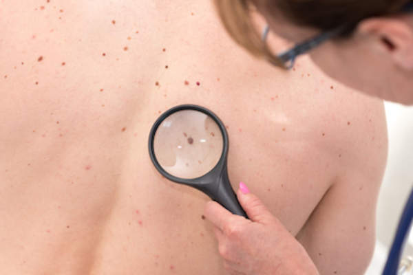 Dermatologist doing annual check up on patient.