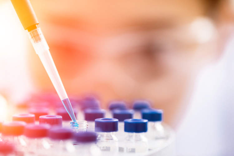 Researcher preparing vials for mass spectrometry.