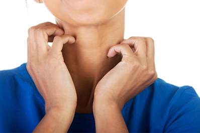 Woman scratching rash on neck.