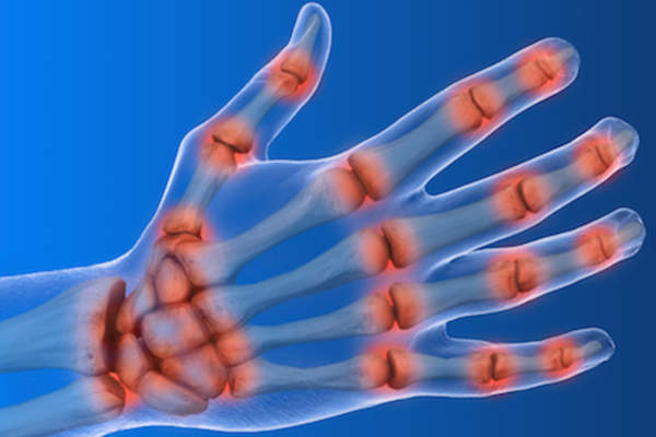 Highlighted small joints of the hand.