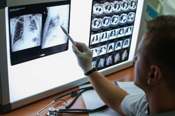 Researching lungs with x-rays.