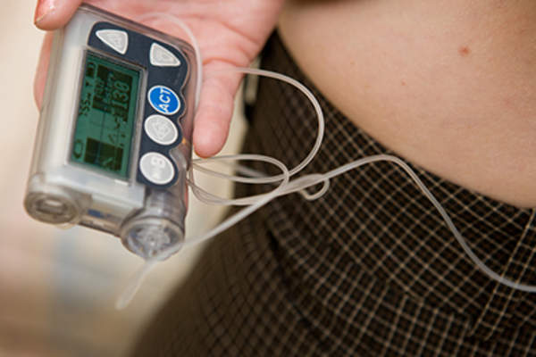 Insulin pump.