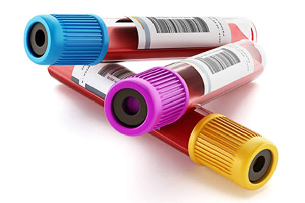 Blood test tubes of blood.