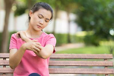 Woman avoids chronic hives outbreaks by understanding what triggers them.