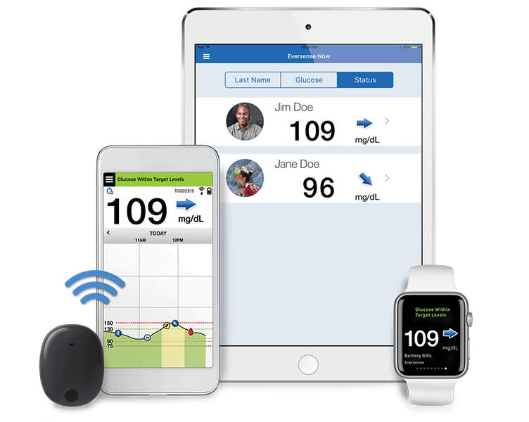 Eversense display.